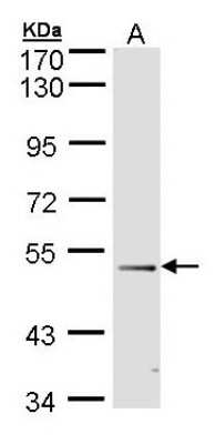 Western Blot: FOXD1 Antibody [NBP1-30959]