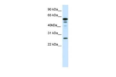 Western Blot: FOXD1 Antibody [NBP3-10404]