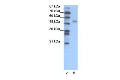 Western Blot: FOXD2 Antibody [NBP2-84024]