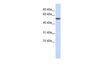 Western Blot: FOXD4 Antibody [NBP2-84026]