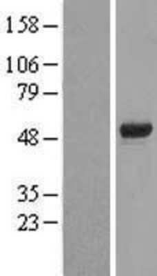 Western Blot: FOXD4 Overexpression Lysate [NBP2-04508]