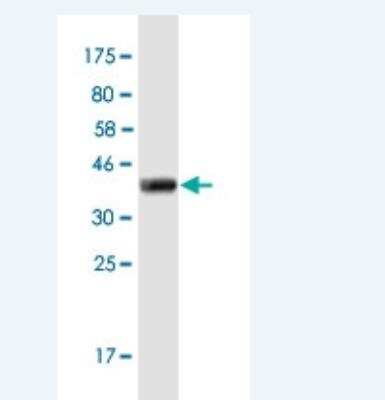 Western Blot: FOXD4L1 Antibody (8A8) [H00200350-M04-100ug]