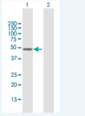 Western Blot: FOXD4L1 Antibody [H00200350-B01P-50ug]