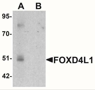 Western Blot: FOXD4L1 AntibodyBSA Free [NBP2-41158]