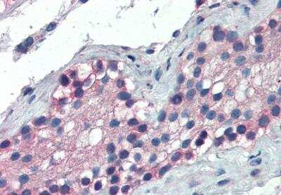 Immunohistochemistry-Paraffin: FOXE1 Antibody [NB100-1271]