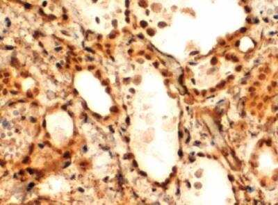 Immunohistochemistry-Paraffin: FOXE1 Antibody [NB100-1271]