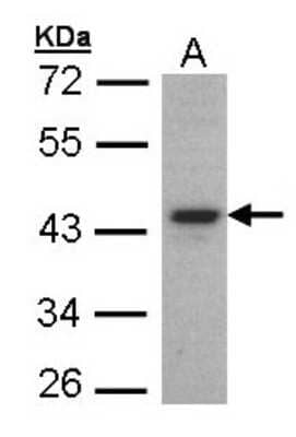 Western Blot: FOXE1 Antibody [NBP1-30960]