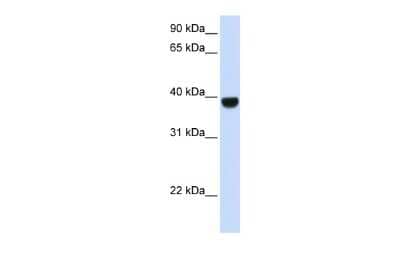 Western Blot: FOXE1 Antibody [NBP2-86632]