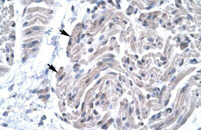 Immunohistochemistry: FOXE3 Antibody [NBP3-10932]