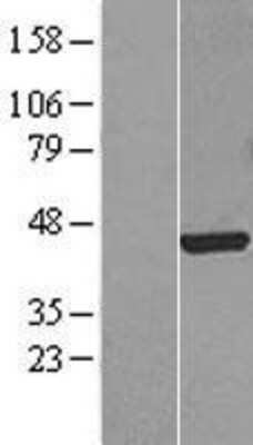 Western Blot: FoxF1 Overexpression Lysate [NBL1-10803]