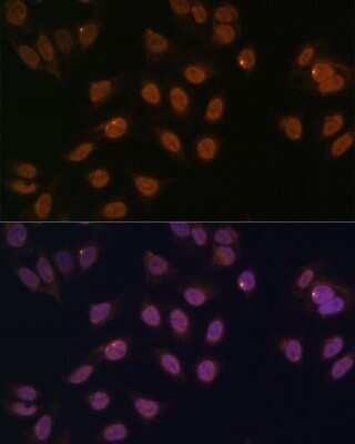 Immunocytochemistry/ Immunofluorescence: FOXG1 Antibody - Azide and BSA Free [NBP3-04084]