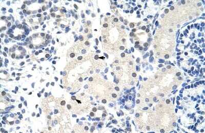 Immunohistochemistry: FOXG1 Antibody [NBP2-86635]