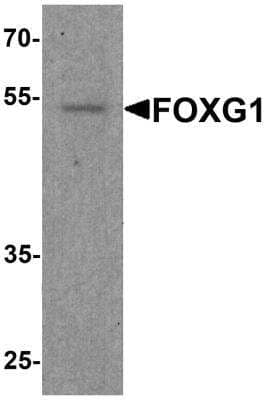 Western Blot: FOXG1 AntibodyBSA Free [NBP2-81942]