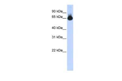 Western Blot: FOXG1 Antibody [NBP2-86634]