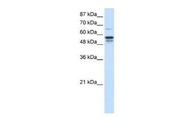 Western Blot: FOXG1 Antibody [NBP2-86635]