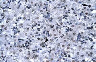 Immunohistochemistry-Paraffin: FOXG1 Antibody [NBP1-56594]