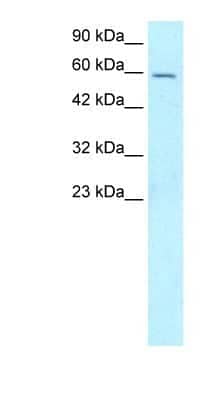 Western Blot: FOXG1 Antibody [NBP1-56594]