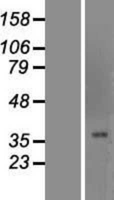 Western Blot: FOXG1 Overexpression Lysate [NBP2-10480]