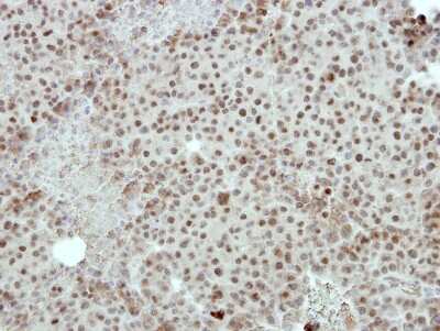 Immunohistochemistry-Paraffin: FOXI1 Antibody [NBP2-16518]