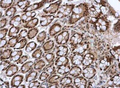 Immunohistochemistry-Paraffin: FOXI1 Antibody [NBP2-16518]