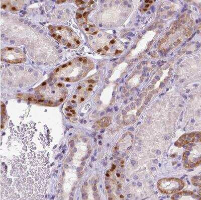 Immunohistochemistry-Paraffin: FOXI1 Antibody [NBP2-49660]