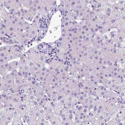 Immunohistochemistry-Paraffin: FOXI1 Antibody [NBP2-49660]