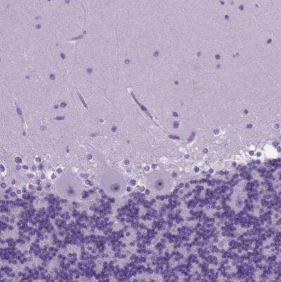 Immunohistochemistry-Paraffin: FOXI1 Antibody [NBP2-49660]
