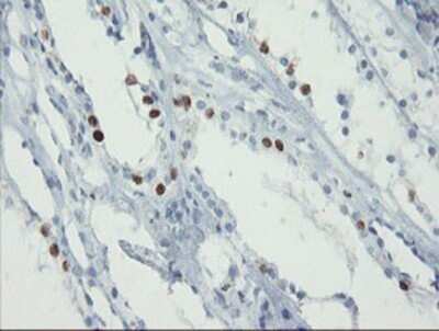 Immunohistochemistry: FOXI1 Antibody (OTI1D4) - Azide and BSA Free [NBP2-70747]