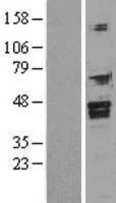 Western Blot: FOXI1 Overexpression Lysate [NBL1-10805]