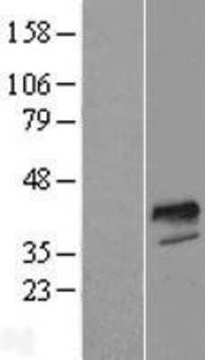 Western Blot: FOXI1 Overexpression Lysate [NBP2-05518]