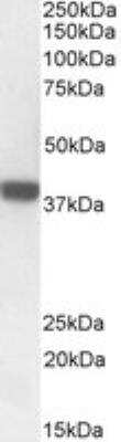 Western Blot: FOXI3 Antibody [NBP1-72044]
