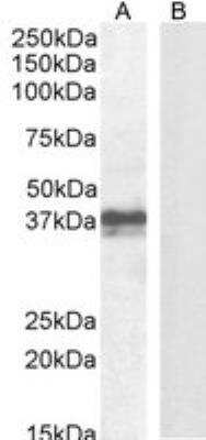 Western Blot: FOXI3 Antibody [NBP1-72044]