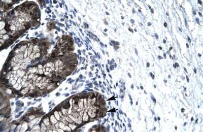 Immunohistochemistry: FOXJ2 Antibody [NBP2-87471]