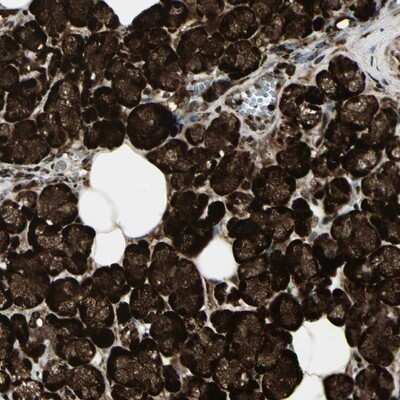 Immunohistochemistry-Paraffin: FOXJ2 Antibody [NBP1-83897]