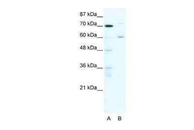 Western Blot: FOXJ2 Antibody [NBP2-87470]