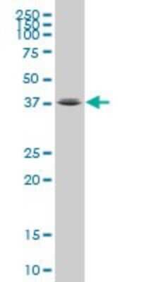 Western Blot: FOXL1 Antibody (1A7) [H00002300-M03]