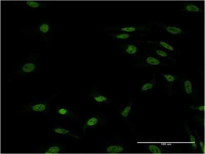 Immunocytochemistry/ Immunofluorescence: FOXL1 Antibody (2F6) [H00002300-M09]