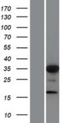 Western Blot: FOXL1 Overexpression Lysate [NBP2-07770]