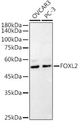 Western Blot: FOXL2 AntibodyAzide and BSA Free [NBP3-03941]