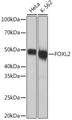 Western Blot: FOXL2 Antibody (4H5X3) [NBP3-16231]