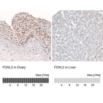 Immunohistochemistry-Paraffin: FOXL2 Antibody (CL12753) [NBP3-18569]