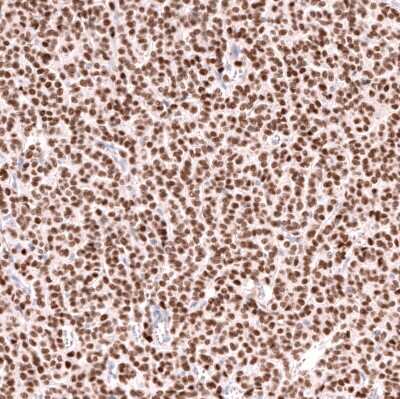 Immunohistochemistry-Paraffin: FOXL2 Antibody (CL12753) [NBP3-18569]