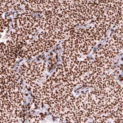 Immunohistochemistry-Paraffin: FOXL2 Antibody (CL12753) [NBP3-18569]