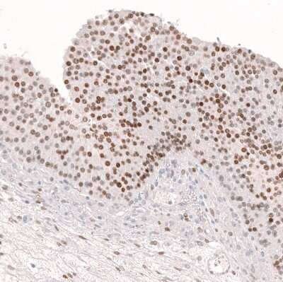 Immunohistochemistry-Paraffin: FOXL2 Antibody (CL12753) [NBP3-18569]