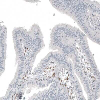 Immunohistochemistry-Paraffin: FOXL2 Antibody (CL12753) [NBP3-18569]