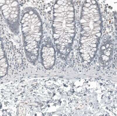 Immunohistochemistry-Paraffin: FOXL2 Antibody (CL12753) [NBP3-18569]