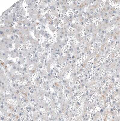 Immunohistochemistry-Paraffin: FOXL2 Antibody (CL12753) [NBP3-18569]