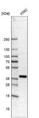 Western Blot: FOXL2 Antibody (CL12753) [NBP3-18569]