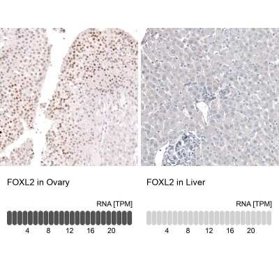 Immunohistochemistry-Paraffin: FOXL2 Antibody (CL12762) [NBP3-18544]