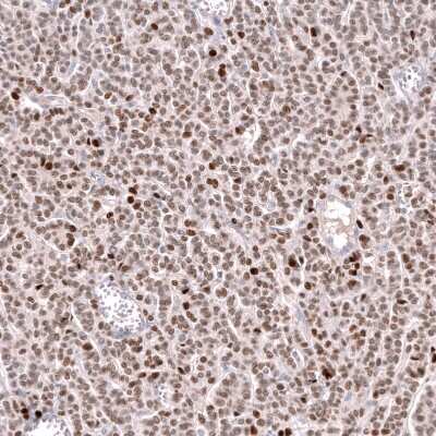 Immunohistochemistry-Paraffin: FOXL2 Antibody (CL12762) [NBP3-18544]